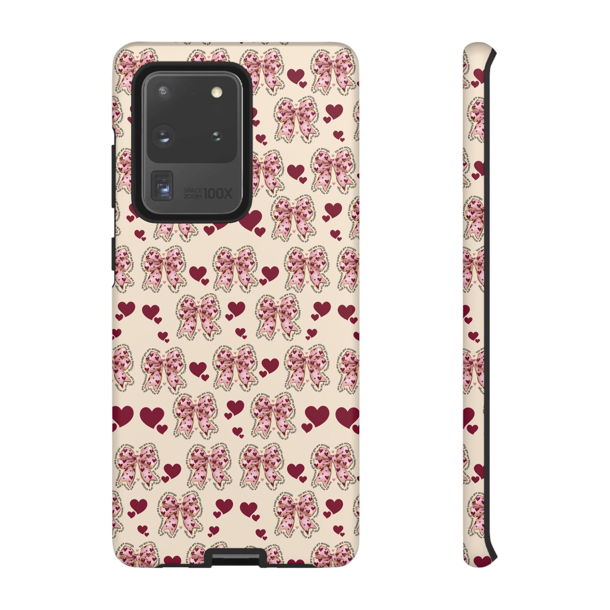 Charming Hearts & Pink Bows Phone Case Stylish & Durable Protection for Your Device | Scratch-Resistant, Slim Fit, and Lightweight Design for Everyday Use for iPhone & Android | Fresh Nature-Inspired Design!